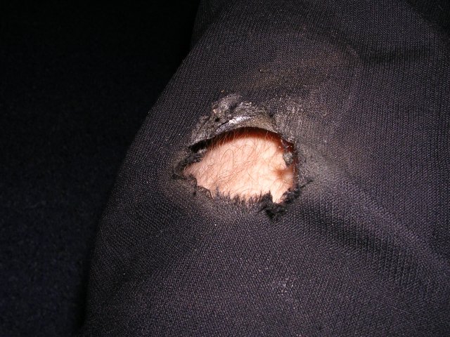 Ripped trousers